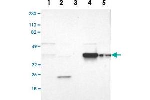 Western Blot analysis of Lane 1: RT-4, Lane 2: U-251MG sp, Lane 3: human plasma (IgG/HSA depleted), Lane 4: human liver and Lane 5: human tonsil lysates with FAM50A polyclonal antibody . (FAM50A Antikörper)