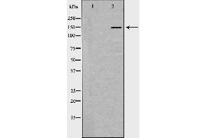 Western blot analysis of extracts of liver , using INSR antibody. (Insulin Receptor Antikörper  (Internal Region))