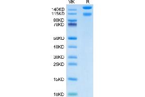 Mouse ITGA1&ITGB1 on Tris-Bis PAGE under reduced condition.