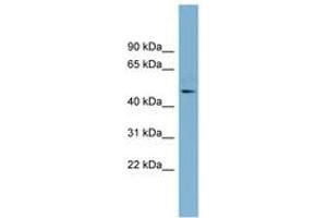 Image no. 1 for anti-Trimethyllysine Hydroxylase, epsilon (TMLHE) (AA 323-372) antibody (ABIN6742153) (TMLHE Antikörper  (AA 323-372))