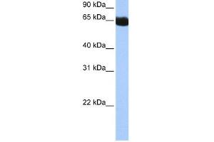 WB Suggested Anti-NSUN6 Antibody Titration:  0. (NSUN6 Antikörper  (N-Term))