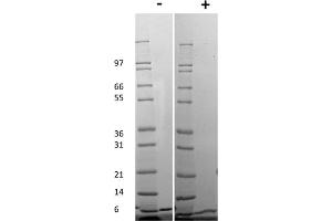 SDS-PAGE (SDS) image for Chemokine (C-X-C Motif) Ligand 1 (Melanoma Growth Stimulating Activity, Alpha) (CXCL1) protein (ABIN6699667)