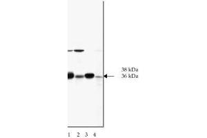 Image no. 1 for anti-SNAP alpha/beta antibody (ABIN364556) (SNAP alpha/beta Antikörper)