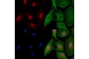 ABIN6257687 and ABIN6274287 staining  cells by IF/ICC. (CEBPG Antikörper  (Internal Region))