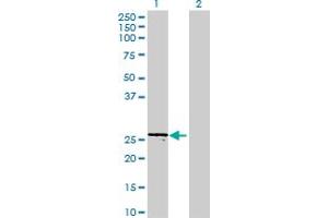 Western Blot analysis of FTSJ2 expression in transfected 293T cell line ( H00029960-T01 ) by FTSJ2 MaxPab polyclonal antibody. (FTSJ2 Antikörper  (AA 1-246))