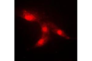 Immunofluorescent analysis of CRABP2 staining in HeLa cells.