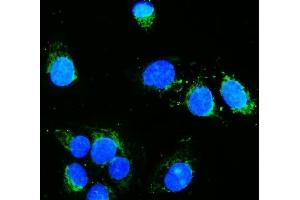 IF analysis of Hexokinase 1/HK1 using anti-Hexokinase 1/HK1 antibody (ABIN7600258). (Hexokinase 1 Antikörper  (AA 17-323))