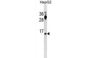 CYYR1 Antibody (C-term) (ABIN1881247 and ABIN2838999) western blot analysis in HepG2 cell line lysates (35 μg/lane). (CYYR1 Antikörper  (C-Term))