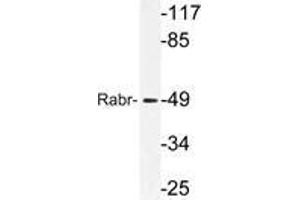 Western blot (WB) analysis of Rabr antibody in extracts from MCF-7cells. (AGFG2 Antikörper)