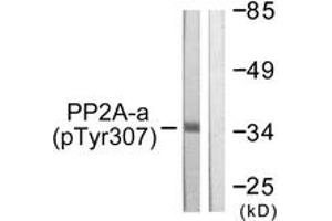 Western blot analysis of extracts from A549 cells, using PP2A-alpha (Phospho-Tyr307) Antibody. (PPP2CA Antikörper  (pTyr307))