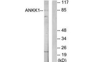 Western blot analysis of extracts from HeLa cells, using ANKK1 Antibody.