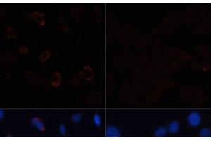 Immunofluorescence analysis of HeLa cells using ACACA Polyclonal Antibody at dilution of 1:100. (Acetyl-CoA Carboxylase alpha Antikörper)