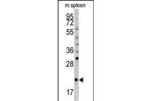 Western blot analysis of anti-mouse BID Antibody (S61) (ABIN388100 and ABIN2846184) in mouse spleen tissue lysates (35 μg/lane). (BID Antikörper  (AA 39-68))