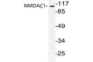Western blot (WB) analyzes of NMDAζ1 antibody in extracts from Jurkat cells. (NMDA 1 Receptor Antikörper)
