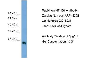 WB Suggested Anti-IFNB1  Antibody Titration: 0. (IFNB1 Antikörper  (Middle Region))