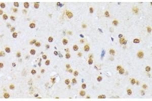 Immunohistochemistry of paraffin-embedded Mouse brain using A1CF Polyclonal Antibody at dilution of 1:100 (40x lens). (A1CF Antikörper)