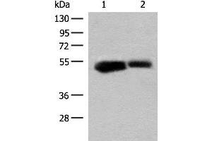 Western blot analysis of Mouse liver tissue and Rat liver tissue lysates using GLUD1 Polyclonal Antibody at dilution of 1:200 (GLUD1 Antikörper)