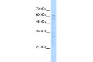 Western Blotting (WB) image for anti-EF-hand calcium binding domain 14 (EFCAB14) antibody (ABIN2463041)