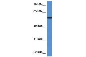 Western Blot showing PGM5 antibody used at a concentration of 1 ug/ml against Fetal Heart Lysate (Phosphoglucomutase 5 Antikörper  (N-Term))