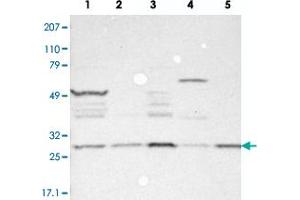 Western blot analysis of Lane 1: RT-4, Lane 2: EFO-21, Lane 3: A-431, Lane 4: Liver, Lane 5: Tonsil with FAM109B polyclonal antibody .