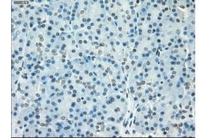 Immunohistochemical staining of paraffin-embedded colon tissue using anti-SSX2mouse monoclonal antibody. (SSX2 Antikörper)