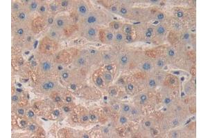 DAB staining on IHC-P; Samples: Human Liver Tissue (MAPKAP Kinase 3 Antikörper  (AA 129-329))