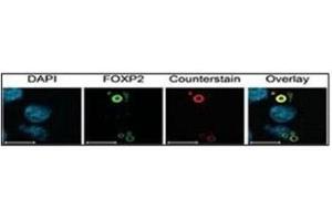 Characterization of FOXP2 isoforms using FOXP2 Ab (green) and Ubiquitin antibody (aggresome marker) (red). (Ubiquitin Antikörper  (AA 36-66))