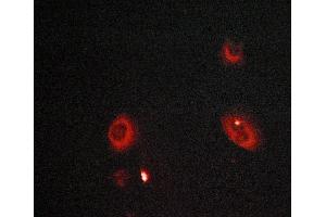 ABIN6268992 staining LOVO cells by ICC/IF. (MMP8 Antikörper  (C-Term))