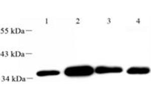 Western blot analysis of FLJ22167 (ABIN7073961) at dilution of 1: 2000,Lane 1: Mouse uterus tissue lysate,Lane 2: Mouse lung tissue lysate,Lane 3: Mouse ovary tissue lysate,Lane 4: Rat ovary tissue lysate (FLJ22167 Antikörper)