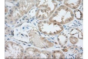 Immunohistochemical staining of paraffin-embedded Human Kidney tissue using anti-BIRC5 mouse monoclonal antibody. (Survivin Antikörper)