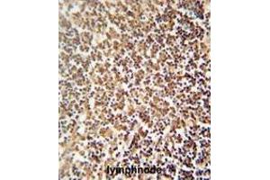 ZNF98 antibody (C-term) immunohistochemistry analysis in formalin fixed and paraffin embedded human lymphnode followed by peroxidase conjugation of the secondary antibody and DAB staining. (ZNF98 Antikörper  (C-Term))