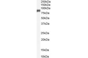Western Blotting (WB) image for anti-Arachidonate 5-Lipoxygenase (ALOX5) (AA 651-666) antibody (ABIN292658) (ALOX5 Antikörper  (AA 651-666))