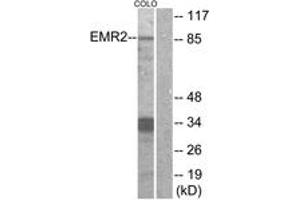 Western blot analysis of extracts from COLO cells, using EMR2 Antibody. (EMR2 Antikörper  (AA 765-814))