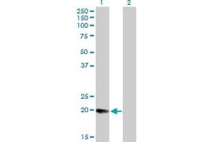 Western Blot analysis of DHRS11 expression in transfected 293T cell line by DHRS11 MaxPab polyclonal antibody. (DHRS11 Antikörper  (AA 1-181))