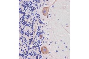 Immunohistochemistry (Paraffin-embedded Sections) (IHC (p)) image for anti-Nestin (NES) (AA 1389-1416) antibody (ABIN388764)