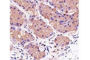 Immunohistochemical analysis of paraffin-embedded human stomach using Pink1 antibody at 1:25 dilution. (PINK1 Antikörper)