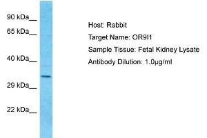 Host: Rabbit Target Name: OR9I1 Sample Type: Fetal Kidney lysates Antibody Dilution: 1. (OR9I1 Antikörper  (C-Term))