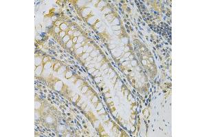 Immunohistochemistry of paraffin-embedded rat intestine using CAMK1D Antibody (ABIN5975586) at dilution of 1/100 (40x lens). (CAMK1D Antikörper)