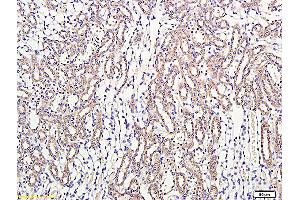 Formalin-fixed and paraffin embedded: rat kidney labeled with Anti-Thrombomodulin/CD141 Polyclonal Antibody, Unconjugated (ABIN669636) at 1:300 followed by conjugation to the secondary antibody and DAB staining (Thrombomodulin Antikörper)