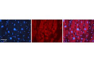 Rabbit Anti-EFEMP1 Antibody   Formalin Fixed Paraffin Embedded Tissue: Human heart Tissue Observed Staining: Cytoplasmic Primary Antibody Concentration: 1:100 Other Working Concentrations: 1:600 Secondary Antibody: Donkey anti-Rabbit-Cy3 Secondary Antibody Concentration: 1:200 Magnification: 20X Exposure Time: 0. (FBLN3 Antikörper  (Middle Region))