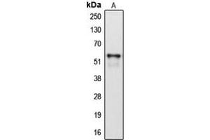 Western blot analysis of Cytochrome P450 2A6 expression in HepG2 (A) whole cell lysates. (CYP2A6 Antikörper  (Center))