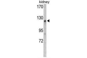 Western blot analysis of WTX antibody (Center) in mouse kidney tissue lysates (35ug/lane). (WTX Antikörper  (Middle Region))