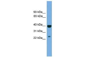 WB Suggested Anti-SOCS1 Antibody Titration:  0. (SOCS1 Antikörper  (Middle Region))