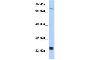 WB Suggested Anti-SAntibody Titration:  0. (SP110 Antikörper  (Middle Region))