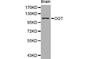 Western blot analysis of extracts of human brain cell line, using OGT antibody. (OGT Antikörper)