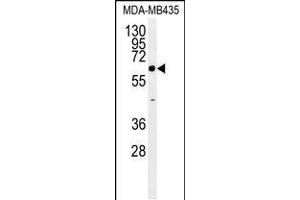 Western blot analysis in MDA-MB435 cell line lysates (35ug/lane). (ERO1LB Antikörper  (C-Term))