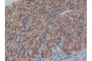 Immunohistochemistry (IHC) image for anti-Chondroitin Sulfate Proteoglycan 5 (Neuroglycan C) (CSPG5) (AA 139-370) antibody (ABIN7442075)