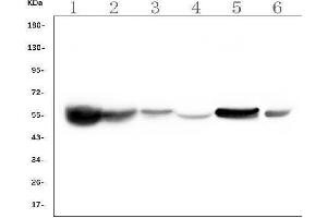 Western blot analysis of ALDH2 using anti-ALDH2 antibody (ABIN7603122). (ALDH2 Antikörper  (N-Term))