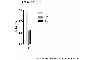 Image no. 2 for anti-Thyroid Hormone Receptor, beta (THRB) (N-Term) antibody (ABIN2779904) (THRB Antikörper  (N-Term))