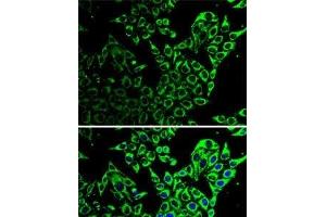 Immunofluorescence analysis of HeLa cells using Hsp60 Polyclonal Antibody (HSPD1 Antikörper)